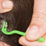 Flea Remover Hook Tick Tweezer Pull Pet Cat Dog Accessaries 3 | PricZone Flea Remover Hook Tick Tweezer Pull Pet Cat Dog Accessaries 3 | PricZone