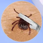 Quality Stainless Steel Pet Flea Remover Tool Scratching 1 | PricZone